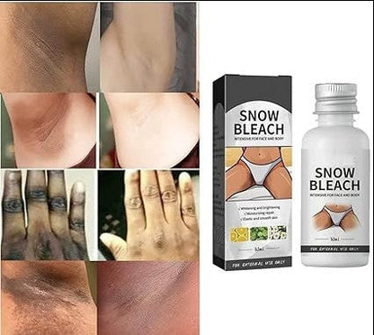 Dark Spot Remover Cream